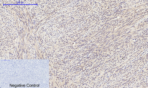 Anti-eIF2 alpha Antibody Anti-eIF2 alpha Antibody