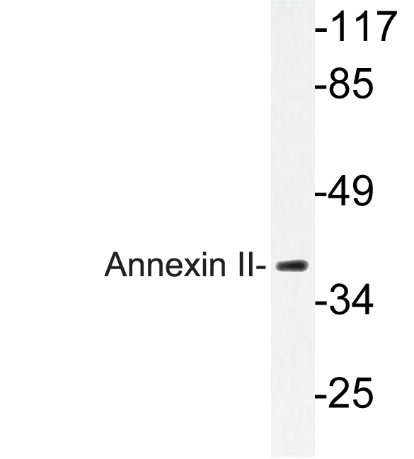 Anti-Annexin II Antibody