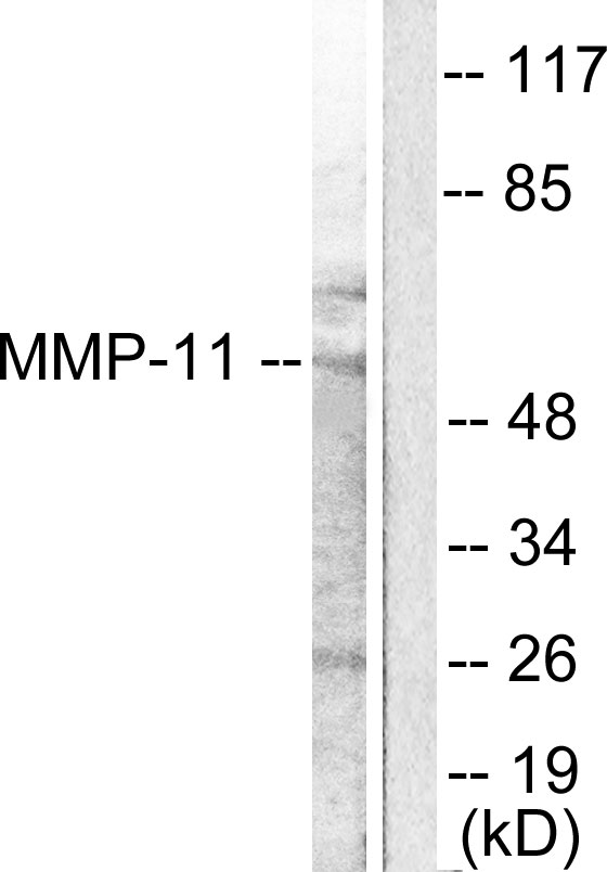 Anti-MMP-11 Antibody - Identical to Abcam (ab119284)