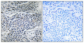 Anti-MMP-11 Antibody - Identical to Abcam (ab119284) Anti-MMP-11 Antibody - Identical to Abcam (ab119284)