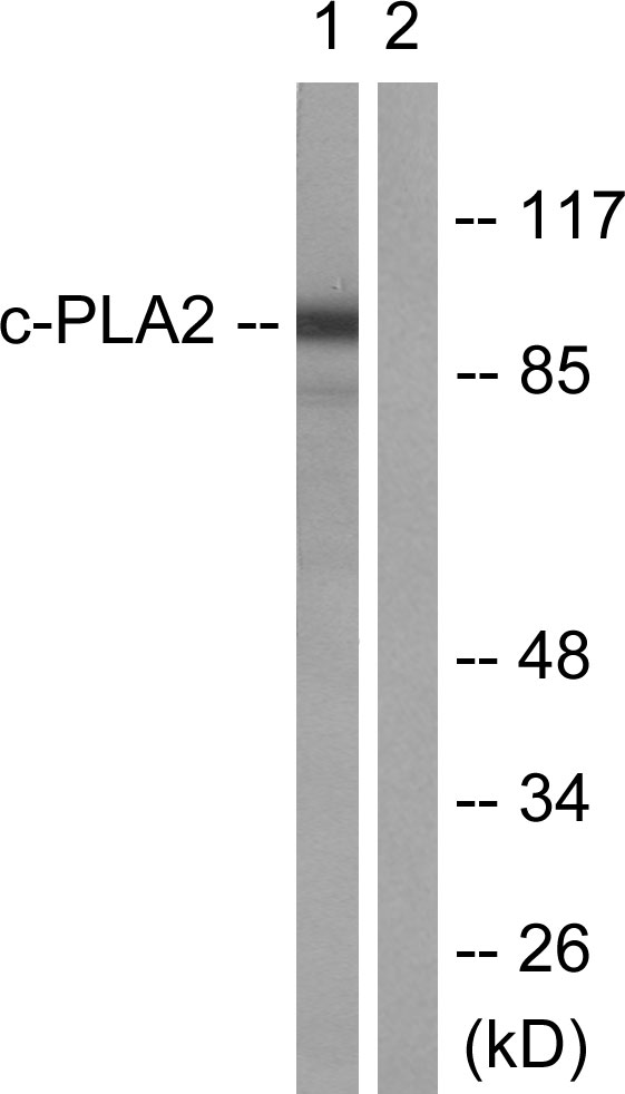 Anti-c-PLA2 Antibody - Identical to Abcam (ab58375)