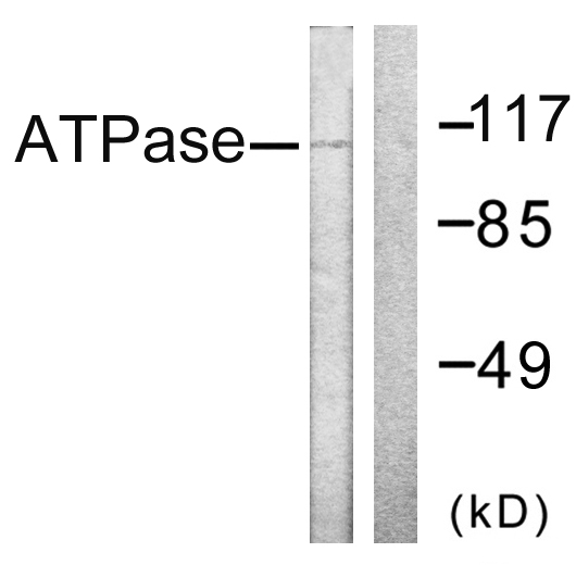 Anti-ATPase Antibody - Identical to Abcam (ab58475)