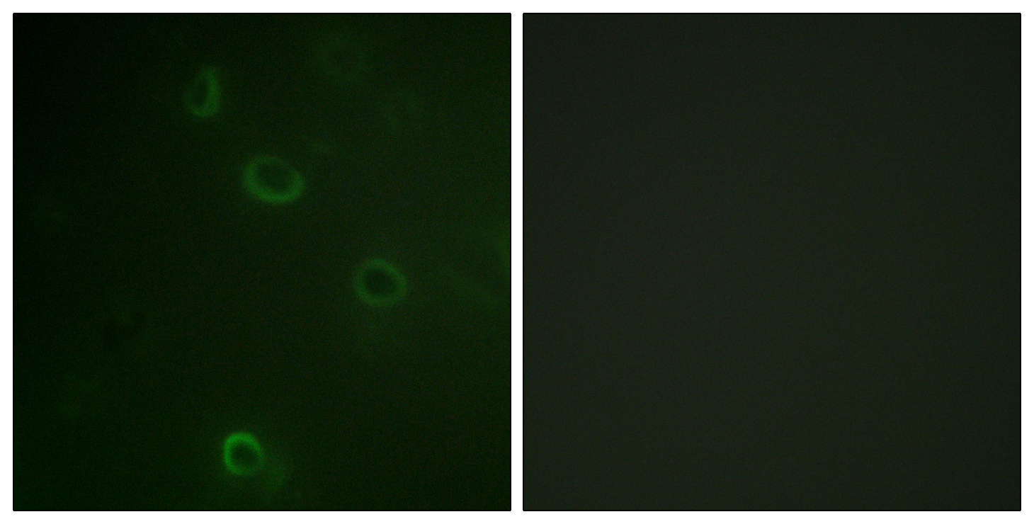 Anti-ATPase Antibody - Identical to Abcam (ab58475) Anti-ATPase Antibody - Identical to Abcam (ab58475)