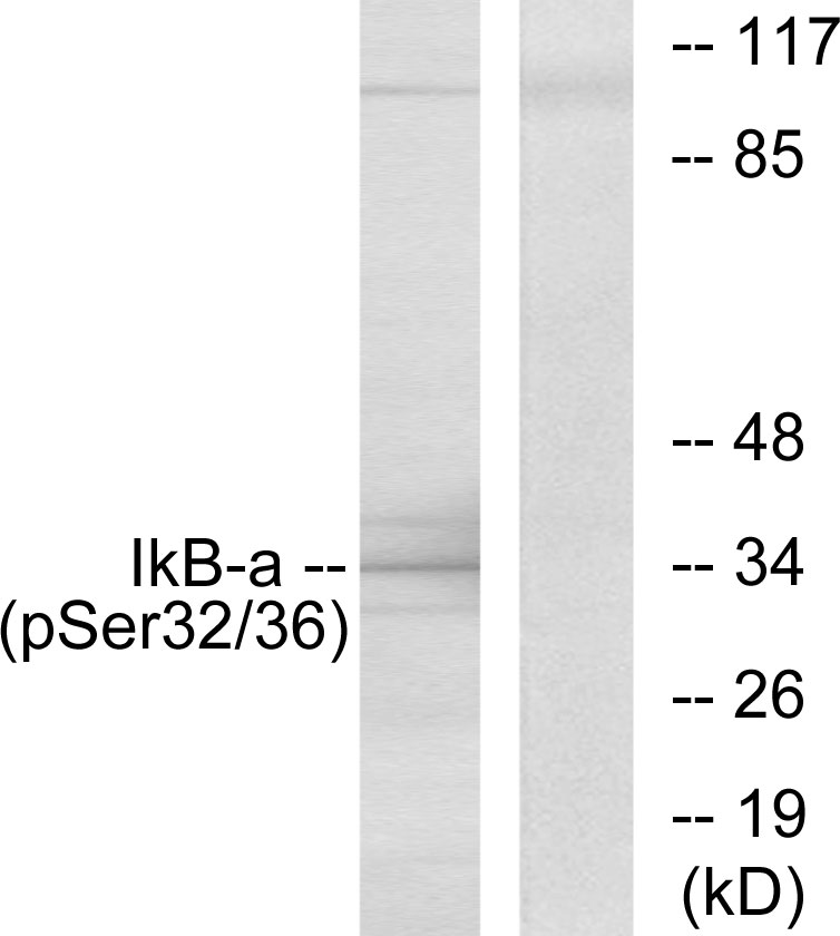 Anti-I kappa B alpha (phospho Ser32 + Ser36) Antibody