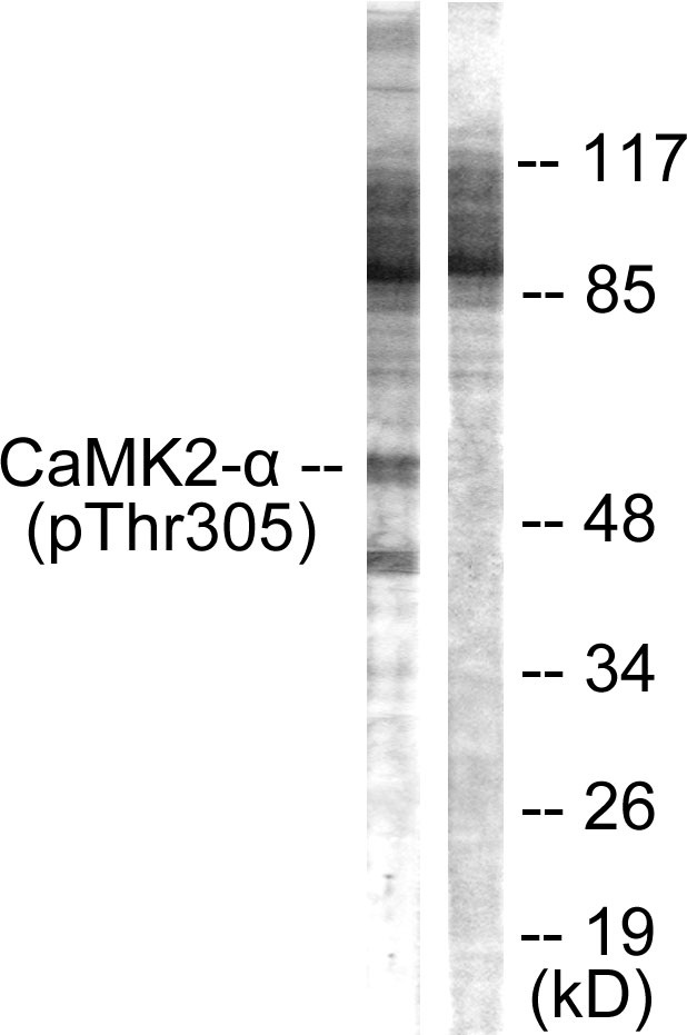 Anti-CaMK2 alpha + beta + delta (phospho Thr305) Antibody