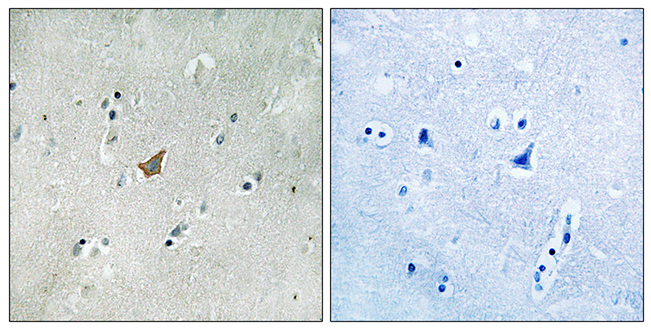 Anti-EPHA3 + EPHA4 + EPHA5 (phospho Tyr779 + Tyr833) Antibody