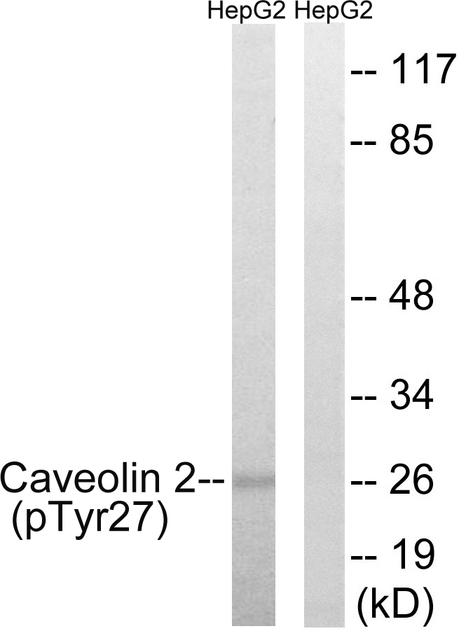 Anti-Caveolin 2 (phospho Tyr27) Antibody