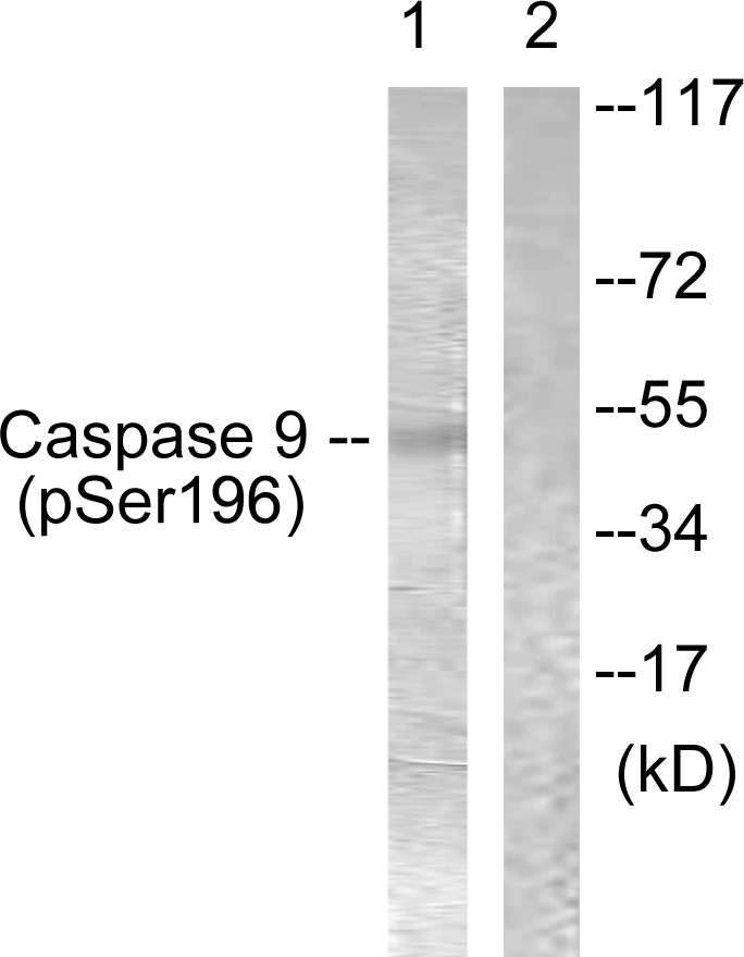 Anti-Caspase 9 (phospho Ser196) Antibody - Identical to Abcam (ab61789)