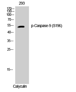 Anti-Caspase 9 (phospho Ser196) Antibody - Identical to Abcam (ab61789) Anti-Caspase 9 (phospho Ser196) Antibody - Identical to Abcam (ab61789)