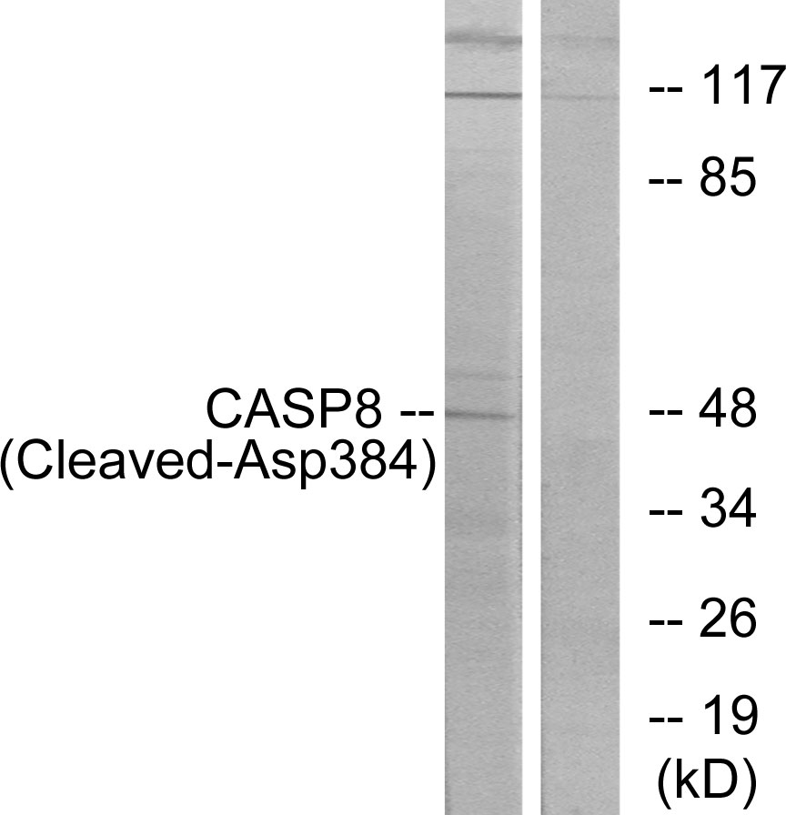Anti-Caspase 8 (cleaved Asp384) Antibody