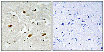 Anti-p27 Kip1 (phospho Thr157) Antibody