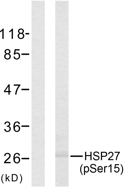Anti-HSP27 (phospho Ser15) Antibody - Identical to Abcam (ab131340)