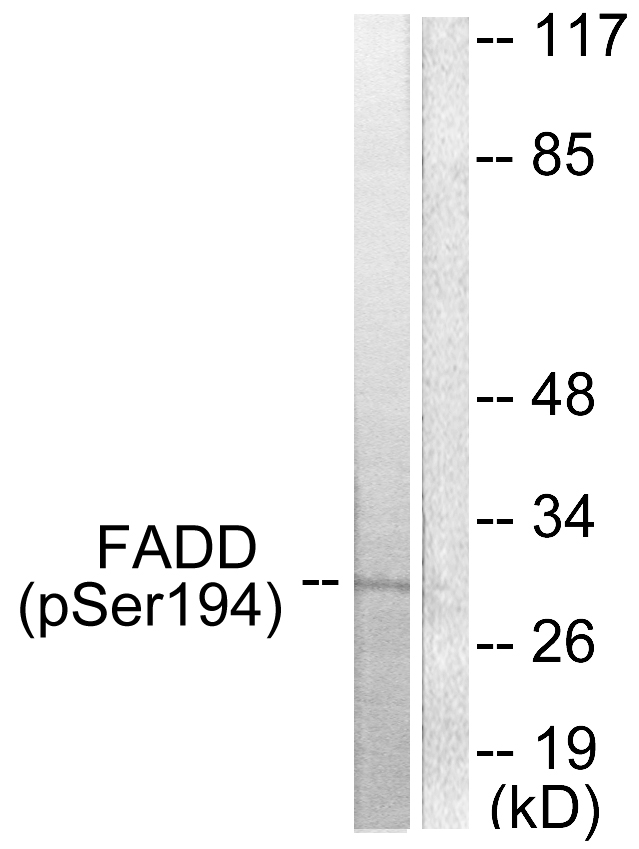 Anti-FADD (phospho Ser194) Antibody