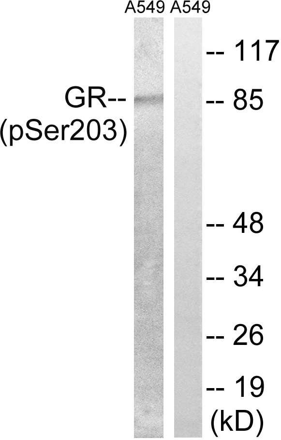 Anti-GR (phospho Ser203) Antibody