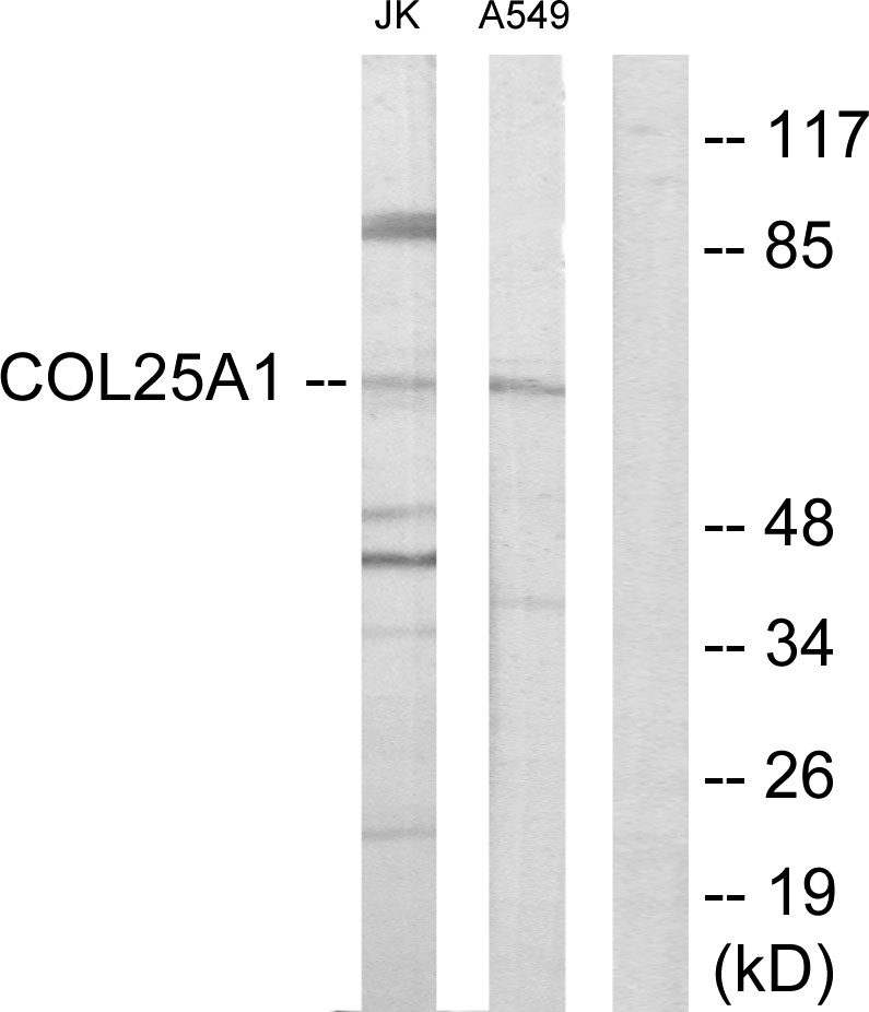 Anti-Collagen XXV alpha1 Antibody
