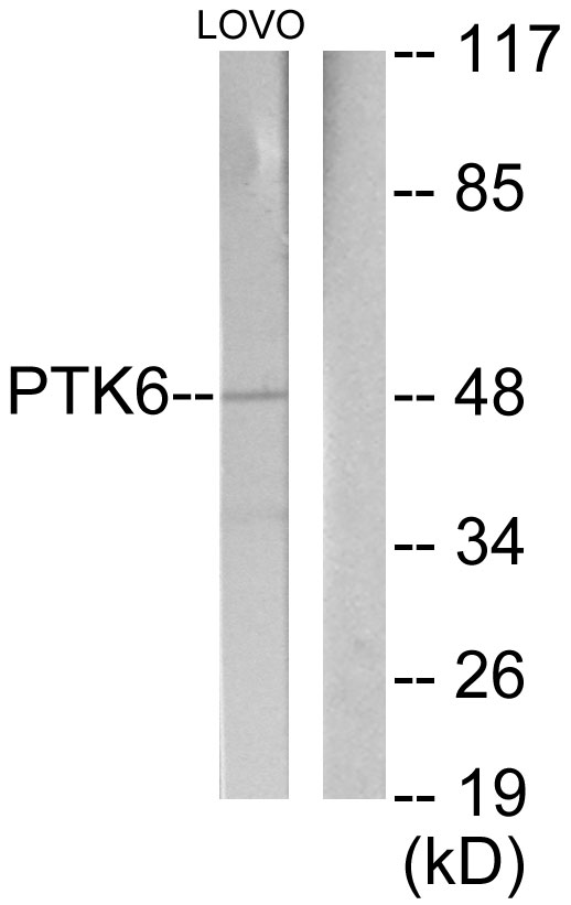 Anti-Breast Tumor Kinase Antibody