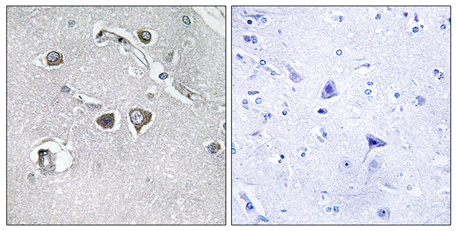 Anti-Collagen XI alpha2 Antibody - Identical to Abcam (ab196613)