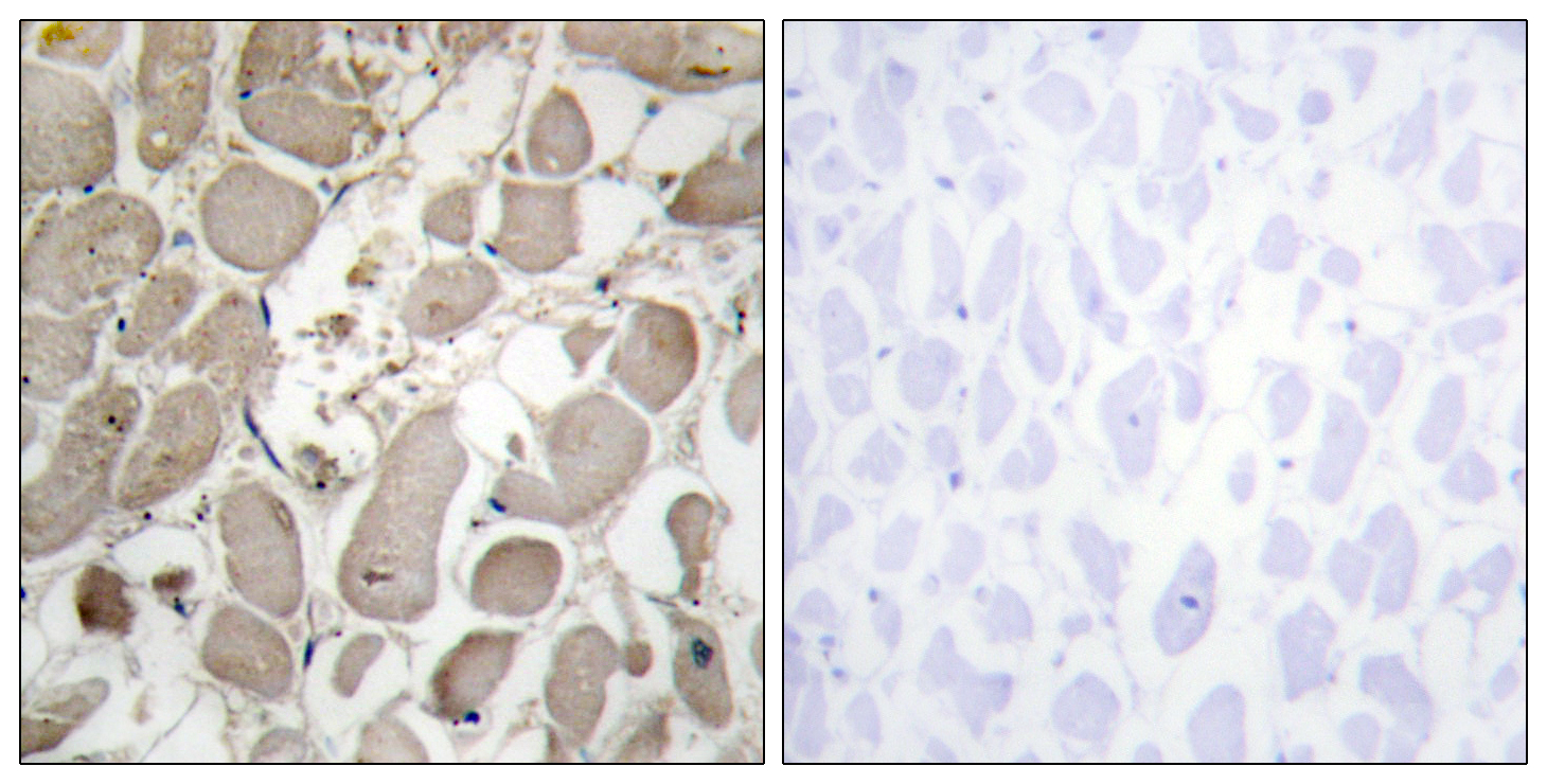 Anti-Collagen V alpha1 Antibody Anti-Collagen V alpha1 Antibody