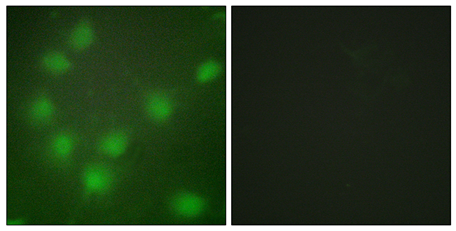 Anti-HOXA11 + HOXD11 Antibody Anti-HOXA11 + HOXD11 Antibody