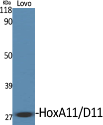Anti-HOXA11 + HOXD11 Antibody Anti-HOXA11 + HOXD11 Antibody
