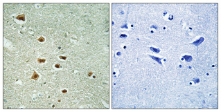 Anti-HOXA11 + HOXD11 Antibody Anti-HOXA11 + HOXD11 Antibody