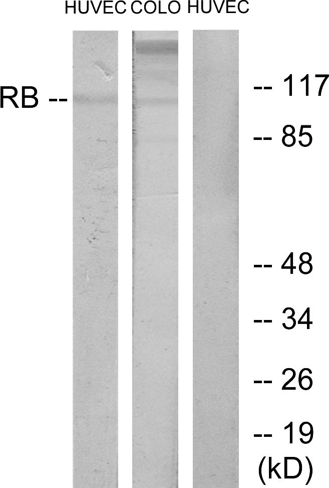 Anti-Retinoblastoma Antibody