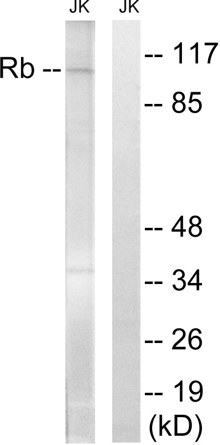 Anti-Retinoblastoma Antibody