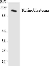 Anti-Retinoblastoma Antibody