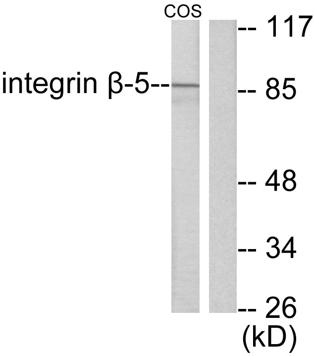 Anti-Integrin beta5 Antibody
