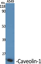 Anti-Caveolin-1 Antibody Anti-Caveolin-1 Antibody