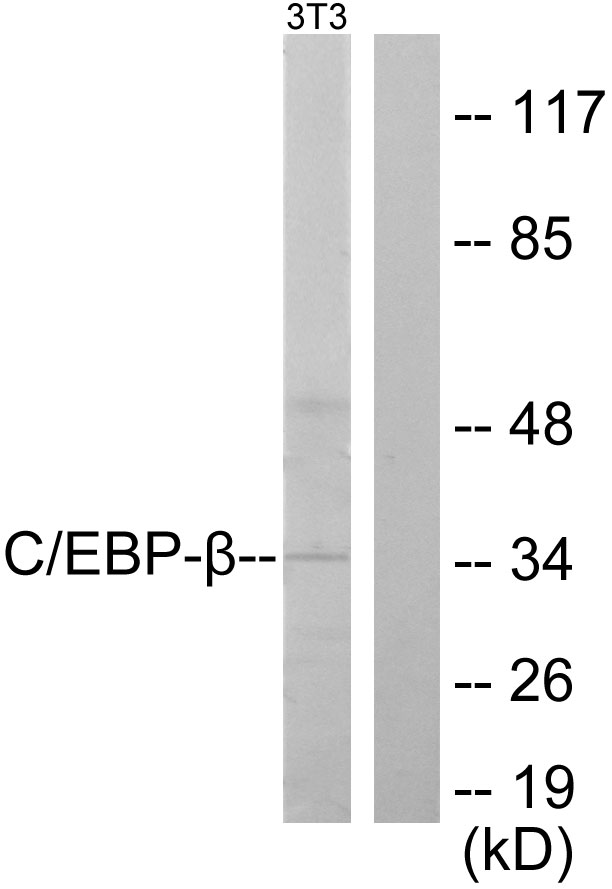 Anti-CEBP beta Antibody - Identical to Abcam (ab53138)
