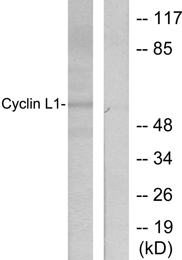Anti-Cyclin L1 Antibody