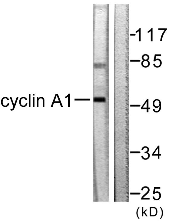 Anti-Cyclin A1 Antibody