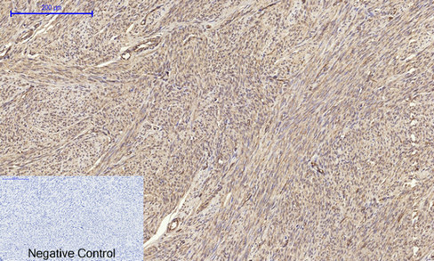 Anti-Claudin 5 Antibody Anti-Claudin 5 Antibody
