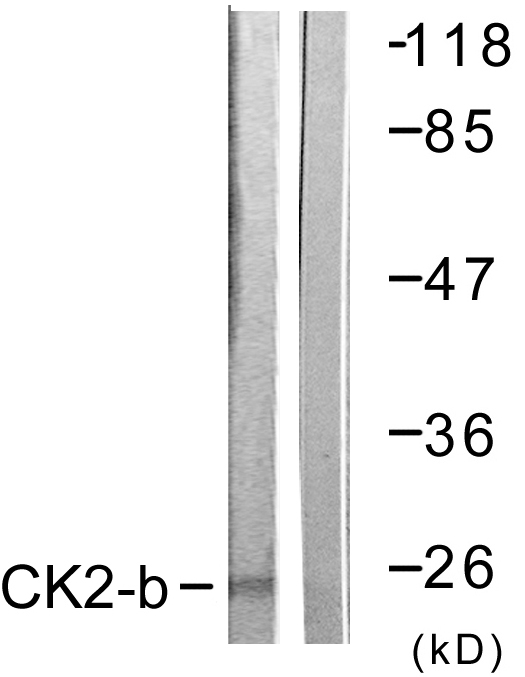 Anti-CKII-beta Antibody
