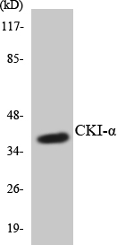 Anti-CKI-alpha Antibody