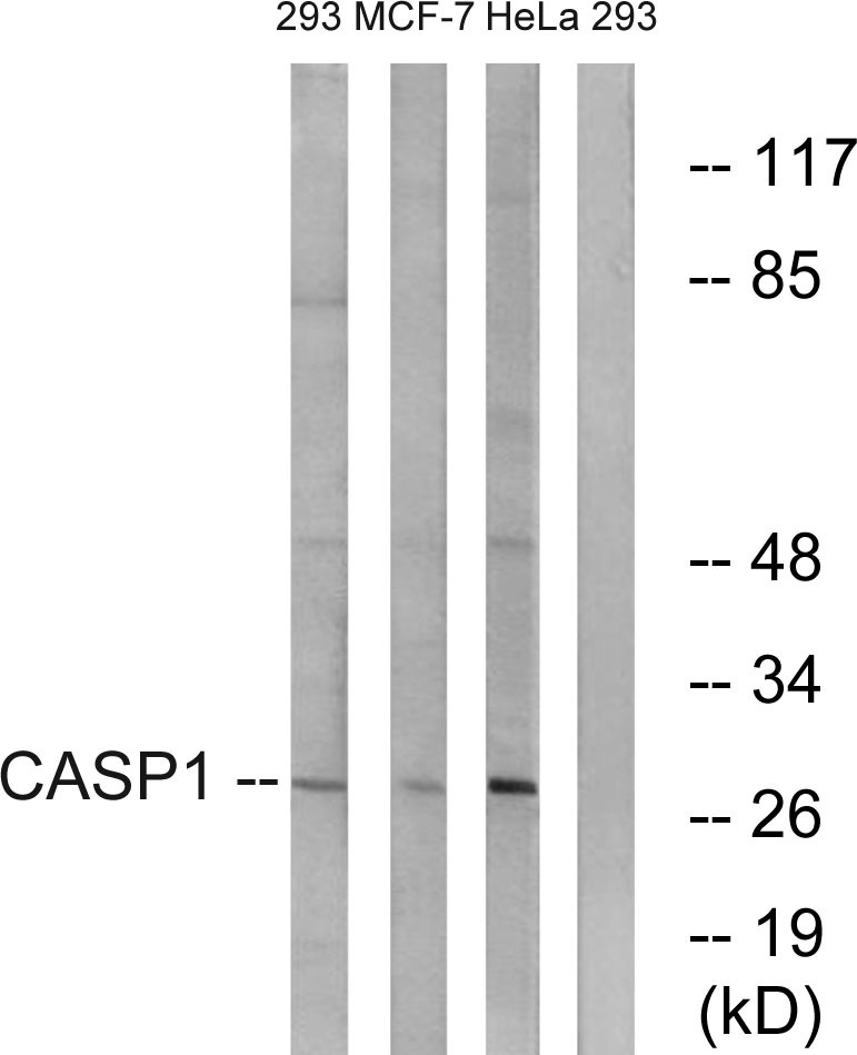 Anti-Caspase 1 Antibody - Identical to Abcam (ab62698)