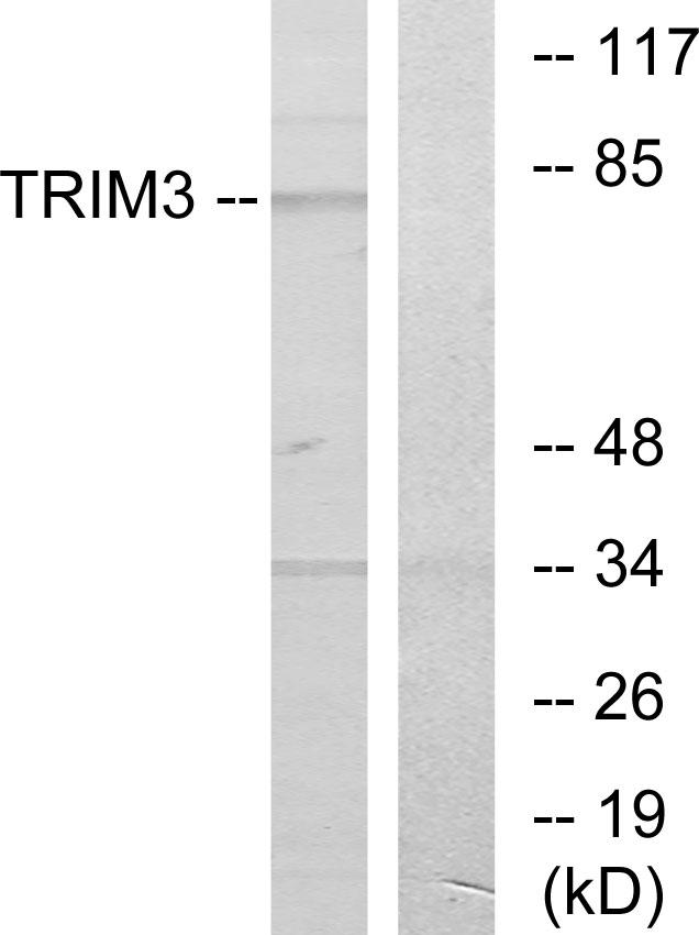 Anti-TRIM3 Antibody