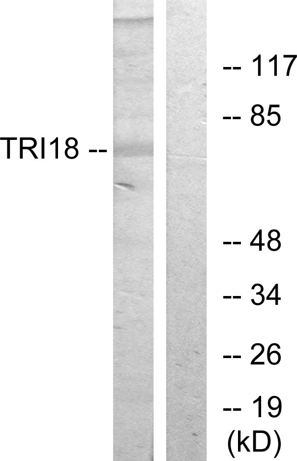 Anti-TRI18 Antibody - Identical to Abcam (ab70770)