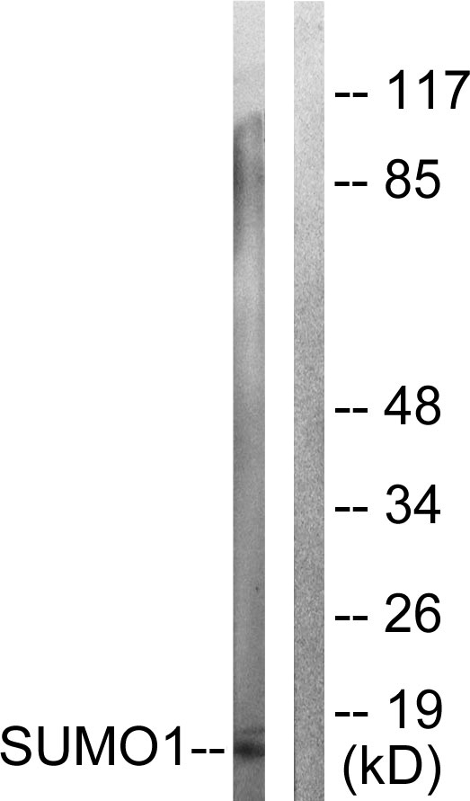 Anti-Sumo1 Antibody