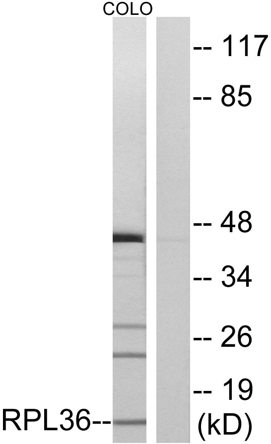 Anti-RPL36 Antibody - Identical to Abcam (ab196734)