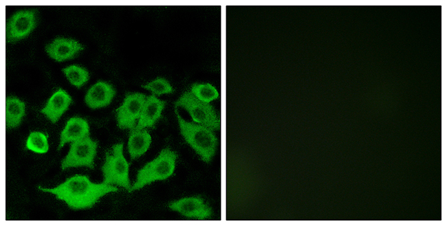 Anti-RPL36 Antibody - Identical to Abcam (ab196734) Anti-RPL36 Antibody - Identical to Abcam (ab196734)
