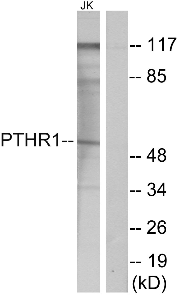 Anti-PTHR1 Antibody - Identical to Abcam (ab75150)