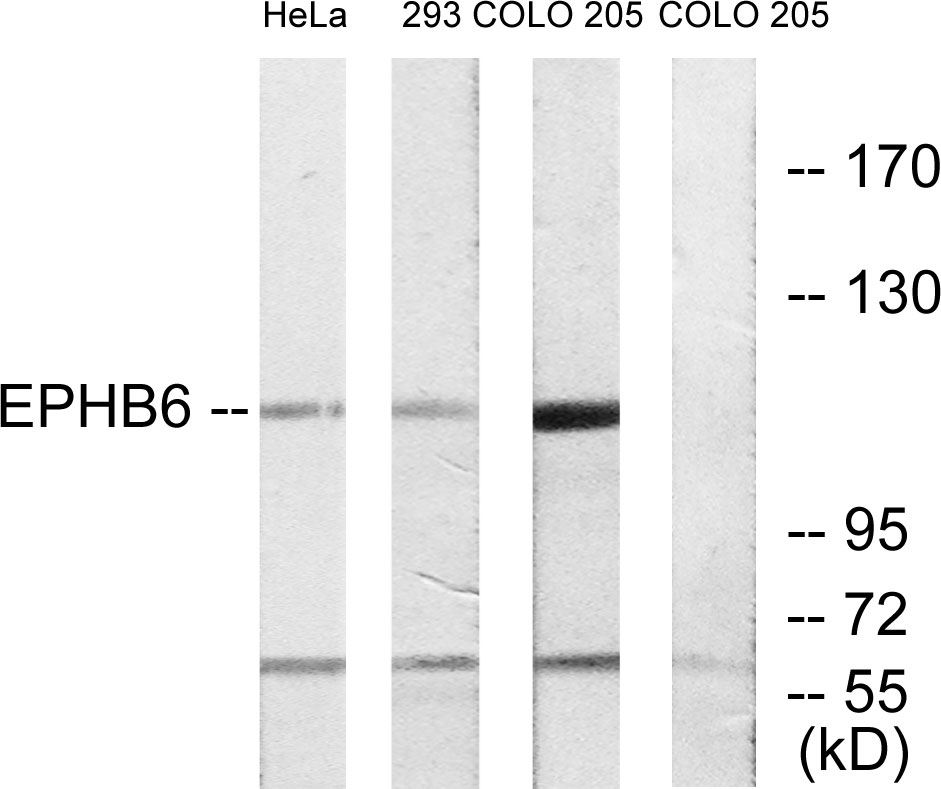 Anti-EPHB6 Antibody