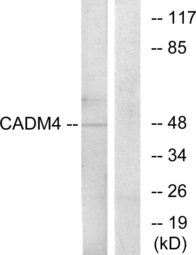Anti-CADM4 Antibody - Identical to Abcam (ab139395)