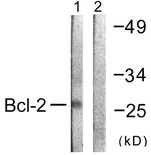 Anti-BCL-2 Antibody - Identical to Abcam (ab59348) and Sigma (SAB4500003)