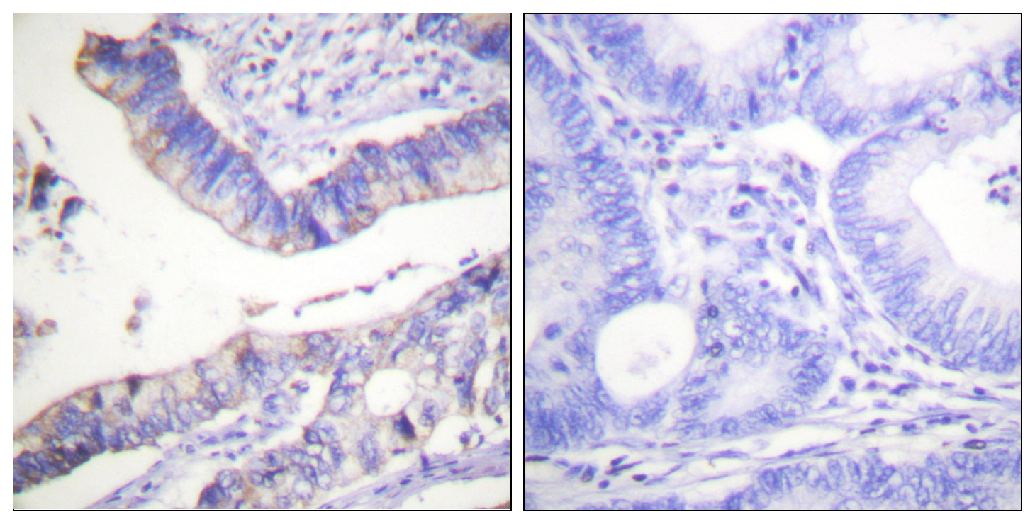 Anti-BCL-2 Antibody - Identical to Abcam (ab59348) and Sigma (SAB4500003) Anti-BCL-2 Antibody - Identical to Abcam (ab59348) and Sigma (SAB4500003)