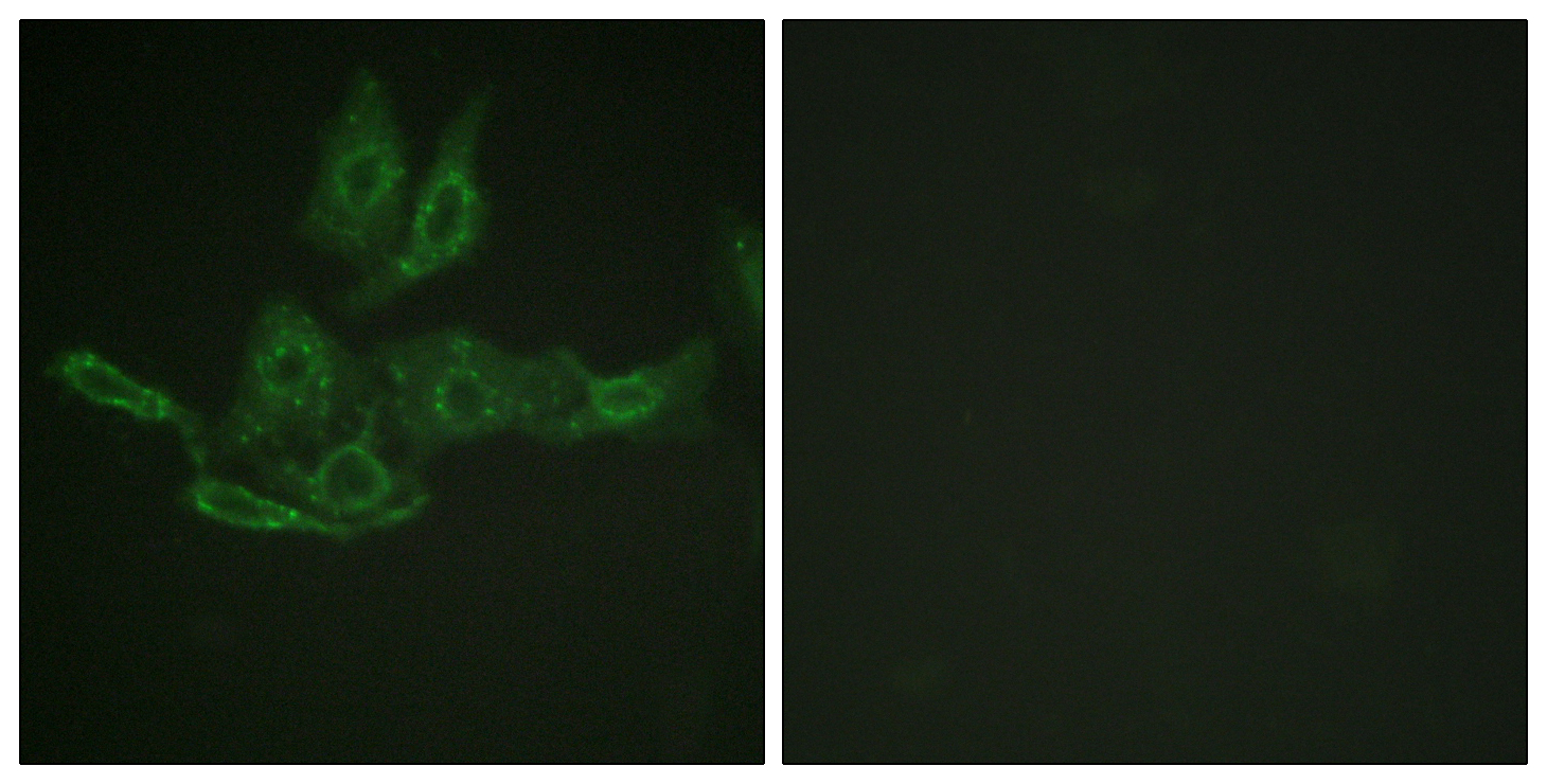 Anti-BCL-2 Antibody - Identical to Abcam (ab59348) and Sigma (SAB4500003) Anti-BCL-2 Antibody - Identical to Abcam (ab59348) and Sigma (SAB4500003)