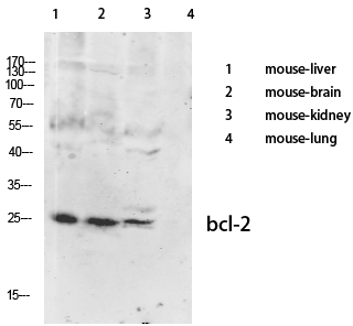 Anti-BCL-2 Antibody - Identical to Abcam (ab59348) and Sigma (SAB4500003) Anti-BCL-2 Antibody - Identical to Abcam (ab59348) and Sigma (SAB4500003)