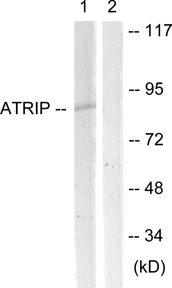 Anti-ATRIP Antibody
